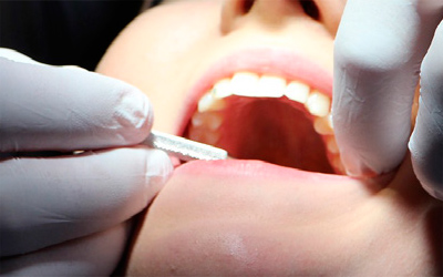 El seguro dental como parte de una buena salud integral